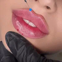 تزریق ژل وبوتاکس