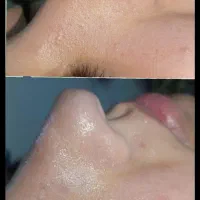 پدیکور پا