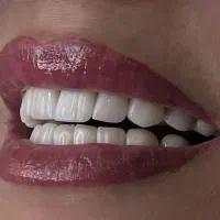 جشنواره دندانپزشکی با بالاترین کیفیت  تخفیف|خدمات آرایشگری و زیبایی|اردبیل, |دیوار
