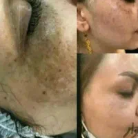 کرم معجزه شب اصل رفع لک وجوش وسفیدشدن پوست|آرایشی، بهداشتی، درمانی|قم, چهار مردان|دیوار