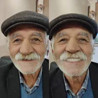 لابراتوار دندانسازی اهورا،دندان مصنوعی