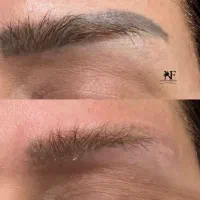 ریموو تک‌جلسه ای با رجووی اصل ومیکروبلیدینگ شیدینگ|خدمات آرایشگری و زیبایی|رشت, لاکانی|دیوار