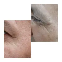 مدل برای زیبایی تخفیف ویژه