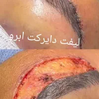 تخفیف ویژه خدمات زیبایی|خدمات آرایشگری و زیبایی|کوهدشت, |دیوار