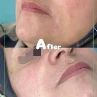 کانتورینگ فول فیس ، بوتاکس،لیزر ، ژل وفیلر ،فیشال|خدمات آرایشگری و زیبایی|فردیس, شهرک ۱۱۰|دیوار
