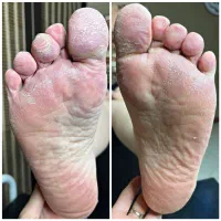 آموزش کفسابی