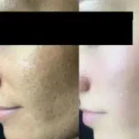 آموزش مجازی و فروش کرم سوپر معجزه اصل