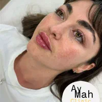 جشنواره ویژه ژل لب،کانتورینگ صورت|خدمات آرایشگری و زیبایی|تهران, شهرک غرب|دیوار