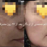 کرم معجزه اصل ضد لک و جوش سفید شدن پوست ضمانتی|آرایشی، بهداشتی، درمانی|لردگان, |دیوار