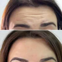 کلینیک تخصصی بوتاکس، ژل، فیلر،طب سوزنی،لاغری|خدمات زیبایی و سلامت|تبریز, |دیوار