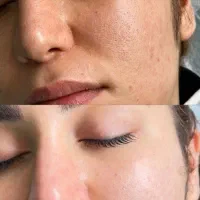 جوانسازی ،درمان پوست ،فیشال،پاکسازی،پوست کره ای|خدمات آرایشگری و زیبایی|شیراز, قدوسی غربی|دیوار