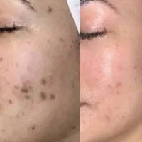 خدمات تخصصی جوانسازی و تقویت پوست و مو