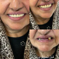 دندان مصنوعی|خدمات آرایشگری و زیبایی|پرند, فاز ۲|دیوار