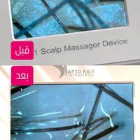 پاکسازی تخصصی کف سر + آنالیز رایگان +تخفیف بینظیر|خدمات آرایشگری و زیبایی|رودهن, |دیوار
