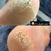 خدمات ویژه پدیکور و اسپا|خدمات آرایشگری و زیبایی|شیراز, شهرک والفجر|دیوار
