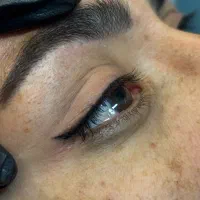 میکروبلیدینگ و‌شیدینگ لب