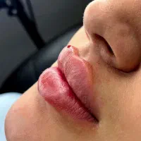 هدیه روز مادر آف ژل وبوتاکس