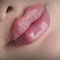 آف ویژه 800 تزریقات وآموزش ژل و بوتاکس پرسینگ|خدمات زیبایی و سلامت|شیراز, لشکری|دیوار