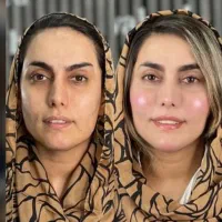 مطب پوست مو لیزر لاغری جوانسازی