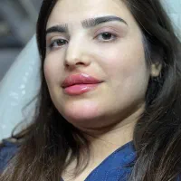 تزریق ژل وبوتاکس|خدمات آرایشگری و زیبایی|جوانرود, |دیوار