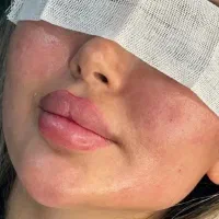 جشنواره فیلر،بوتاکس،جوانساز،انزیم و آموزش