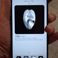 گوشی ردمی ۱۲