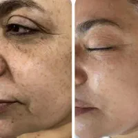 آف و تخفیف ویژه فیشال و پاکسازی آقایان و بانوان