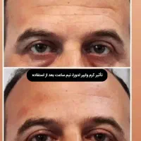 لیفت وایپر|آرایشی، بهداشتی، درمانی|تهران, شهرک محلاتی|دیوار