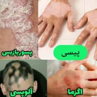 درمان همه بیماری ها
