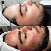 فیشال وپاکسازی آقایان کلینیک پزشک پنجشنبه ۶۹۰