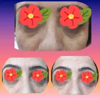 تخفیف بوتاکس، ژل، مزوژل، پی آر پی توسط پزشک|خدمات آرایشگری و زیبایی|مشهد, گوهرشاد|دیوار