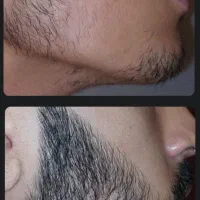 ریش و سیبیل پرپشت و یک دست فقط در 40 روز