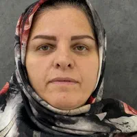 کاشت ابرو حرفه ای طبیعی