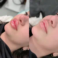 در کلینیک سورین بوتاکس رایگان شماست