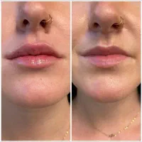 خدمات تخصصی زیبایی، جوانسازی پوست و مو