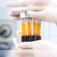 مزوژل جوانساز پوستتو جوان کن prp۹۸۰|خدمات زیبایی و سلامت|اصفهان, بهار آزادی|دیوار