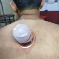 زالو درمانی و حجامت درطب سنتی با ۸ سال سابقه کار|خدمات آرایشگری و زیبایی|سبزوار, شرق کال میانی|دیوار