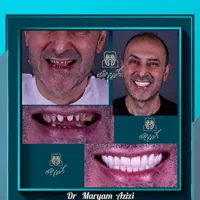مرکز تخصصی دندانپزشکی عصب کشی دندان پزشکی|خدمات آرایشگری و زیبایی|شیراز, معالی‌آباد|دیوار