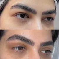 جراحی و زیبایی صورت و بدن، مزو، بوتاکس، چربی، فیلر|خدمات آرایشگری و زیبایی|کرمانشاه, |دیوار