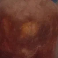 کپسول گاز