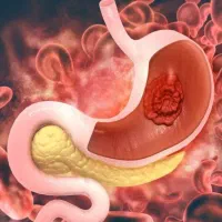 رفع مشکلات معده و گوارش گیاهی