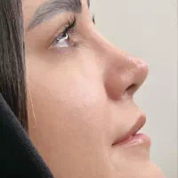 جشنواره عمل بینی