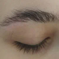 فیبروز ابرو تخصصی