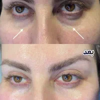 تخفیف ویژه کلینیک زیبایی|خدمات آرایشگری و زیبایی|اردبیل, |دیوار