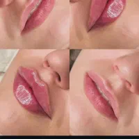 آموزش صفر تا صد زیبایی فیلر و بوتاکس و مزو تراپی|خدمات آرایشگری و زیبایی|اردبیل, |دیوار