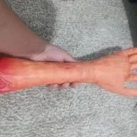 دست مصنوعی طبیعی|آرایشی، بهداشتی، درمانی|کرمانشاه, |دیوار