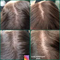 اسکالپ سر .کراتین وپروتین تراپی اپلاسیون بدن|خدمات آرایشگری و زیبایی|تنکابن, |دیوار