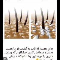 افر ویژه خدمات اسکراب کف سر-درمانی ۲.۵۰۰ تومان|خدمات آرایشگری و زیبایی|کیش, |دیوار