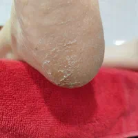 شروع دوره پدیکور|خدمات آموزشی|کرمان, |دیوار