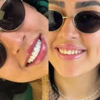 کامپوزیت